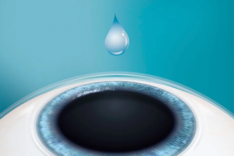 Lasermed Evo Visian ICL: Betäubung des Auges Lasermed Evo Visian ICL: Betäubung des Auges