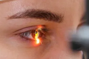 ICL Behandlung: Vermessung und Untersuchung des Auges mit der Spaltlampe vor der ICL Linsenimplantation