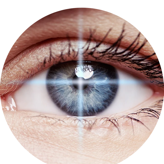 lasermed-augenlasern-relex-smile Lasermed Augenlasern - Die Nr 1 für Ihre Augen in Berlin
