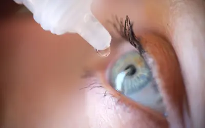 Was hilft wirklich gegen trockene Augen nach einer Augenlaser-OP?