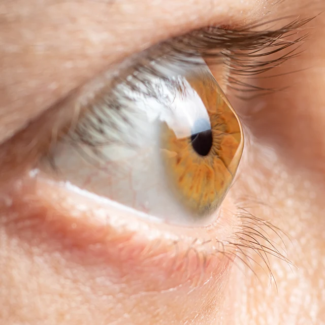 Lasermed Augenlasern - Die Nr 1 für Ihre Augen in Berlin