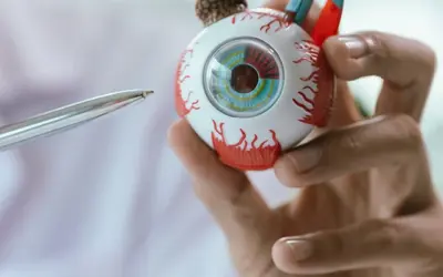 Welche Krankenkasse übernimmt die Kosten für eine Linsenimplantation?