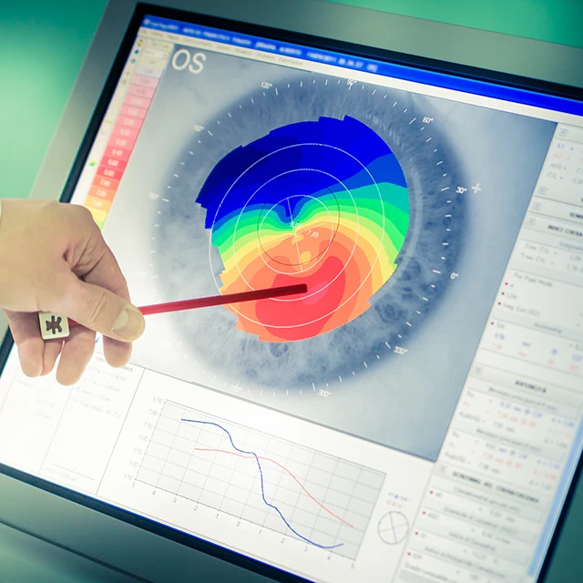 Lasermed Augenlasern - Die Nr 1 für Ihre Augen in Berlin