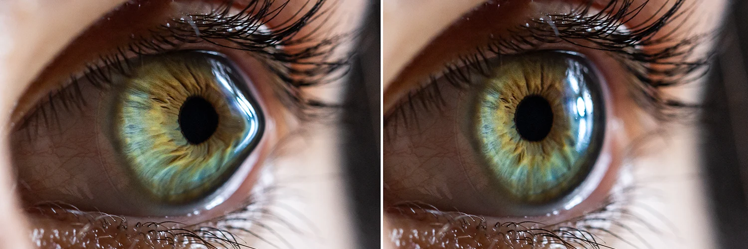 Lasermed Augenlasern - Die Nr 1 für Ihre Augen in Berlin