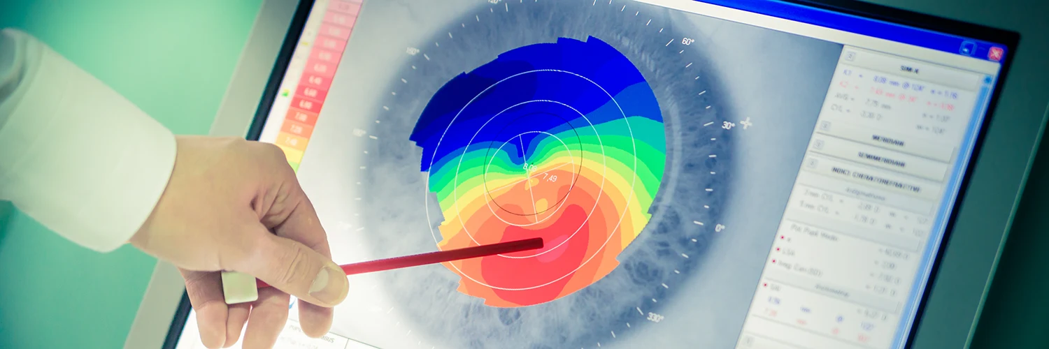 Lasermed Augenlasern - Die Nr 1 für Ihre Augen in Berlin