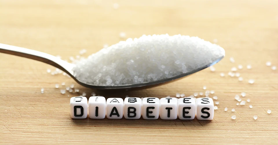 Zucker und der Schriftzug „Diabetes“ als Symbol für LASIK bei Typ-2-Diabetes.