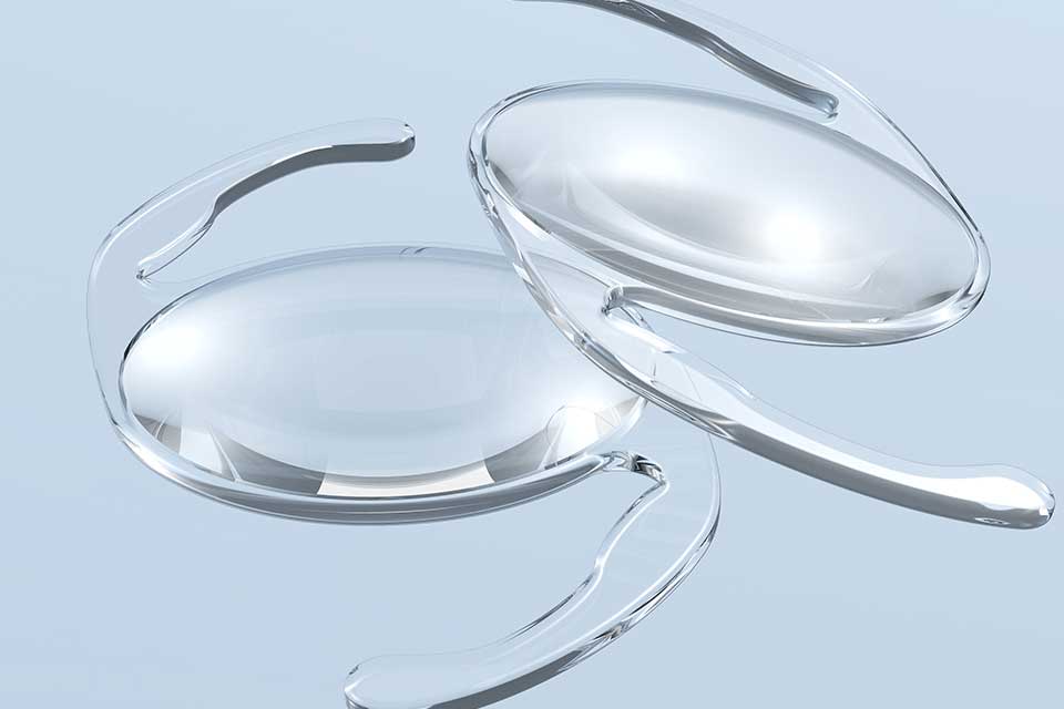 Katarakt (Grauer Star) Behandlung: Zusatzlinsen